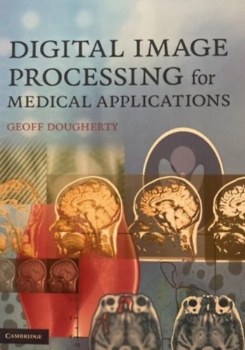 Geoff Dougherty - Digital Image Processing for Medical applications