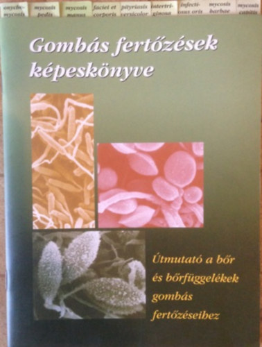 Dr.Pod�nyi Be�ta - Gomb�s fert�z�sek k�pesk�nyve