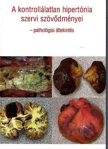 Dr. S�pos G�bor; Dr. Habony Norbet - A kontroll�latlan hipert�nia szervi sz�v�dm�nyei - Pathol�giai �ttekint�s