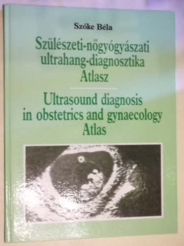 Szlszeti-ngygyszati ultrahang-diagnosztika Atlasz