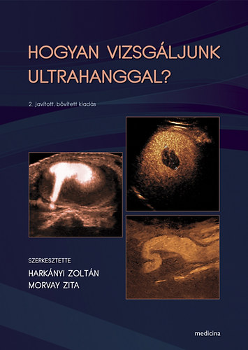 Harknyi Zoltn  (szerk.); Morvay Zita (szerk.) - Hogyan vizsgljunk ultrahanggal?