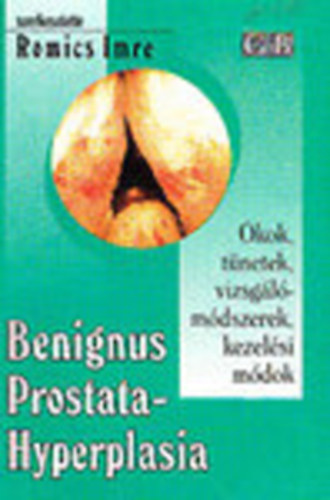Romics Imre  (szerk.) - Benignus prostatahyperplasia