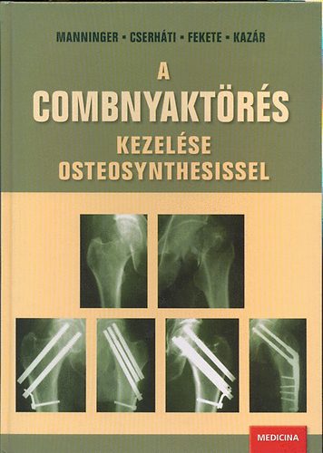 Hanninger Jen�, Dr. Fekete K�roly Cserh�ti P�ter - A combnyakt�r�s kezel�se osteosynthesissel