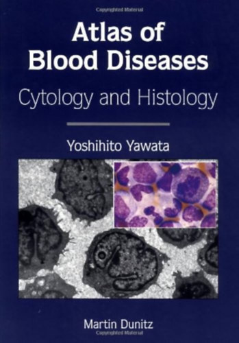Yoshihito Yawata - Atlas of Blood Diseases - Cytology and histology