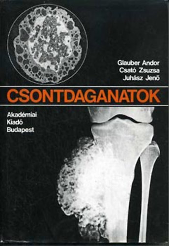 Glauber Andor; Csat� Zsuzsa; Juh�sz Jen� - Csontdaganatok