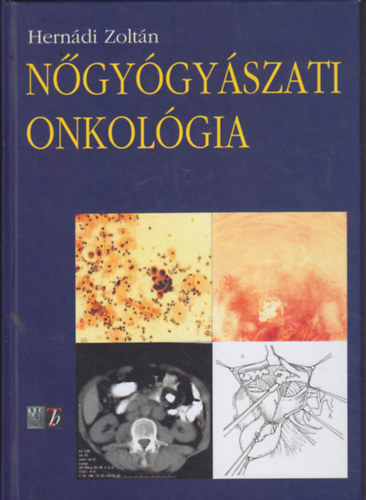 Herndi Zoltn - Ngygyszati onkolgia